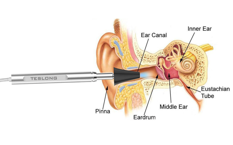 Should We Clean Ear Wax?