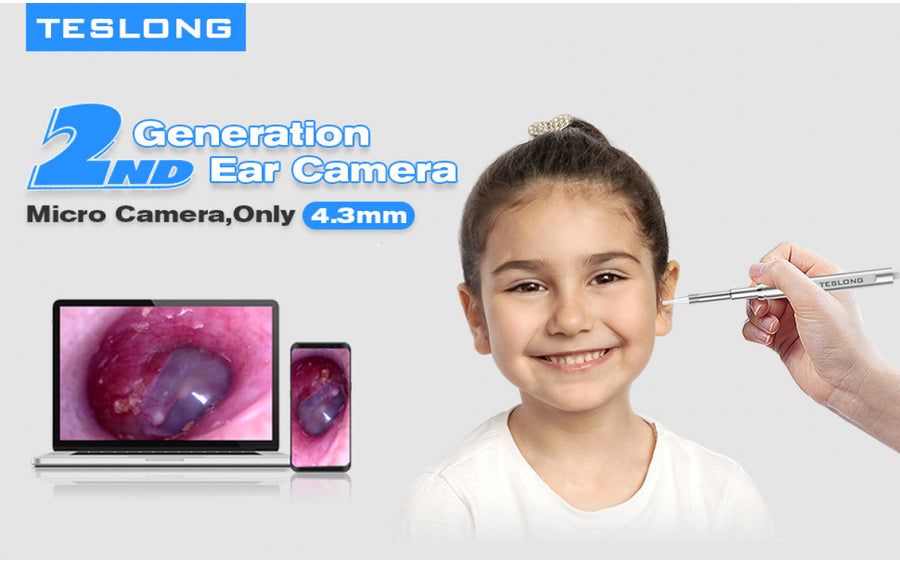 When do we need a ear camera ?