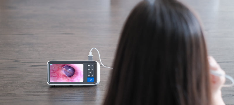 Wi-Fi Otoscopes