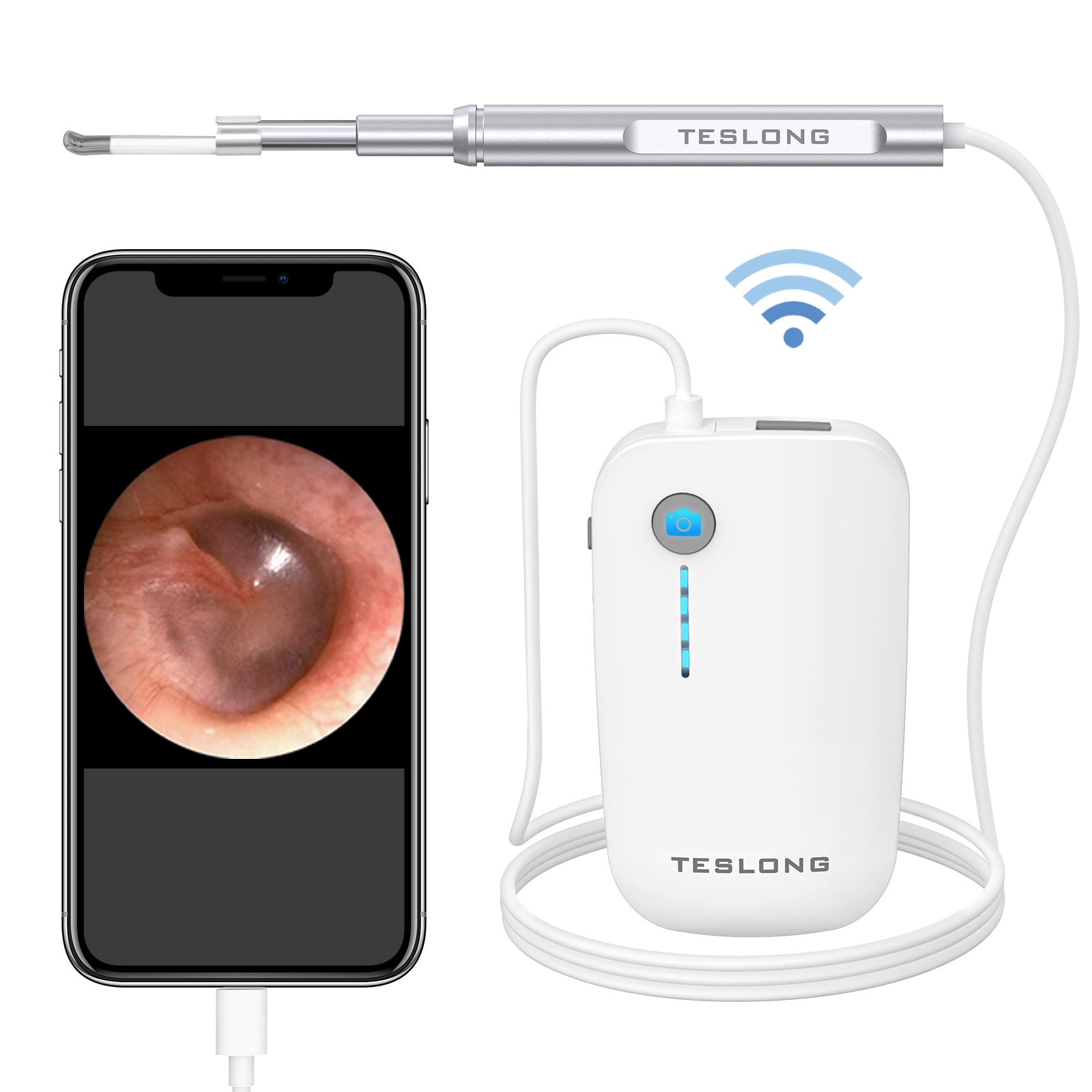 NTE390W / 430W Wi-Fiデジタル耳鏡（iPhone / iPad / Android用）