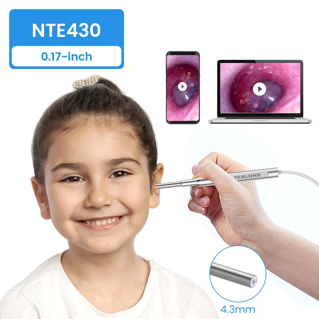NTE430 USB Otoscope: Digital USB Otoscope with Ear Camera